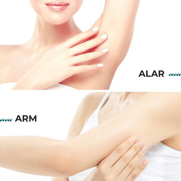 IPL hair removal device Full body hair removal - Flash 999,000 - A10