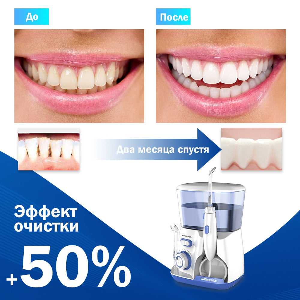 Oral Irrigator V300 Dental Irrigators Teeth Whitening 5 Dental Water Jets 800ml