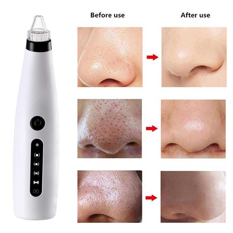 Blackhead Remover Vacuum Cleaner Black Dot Machine Skin Pore Suction
