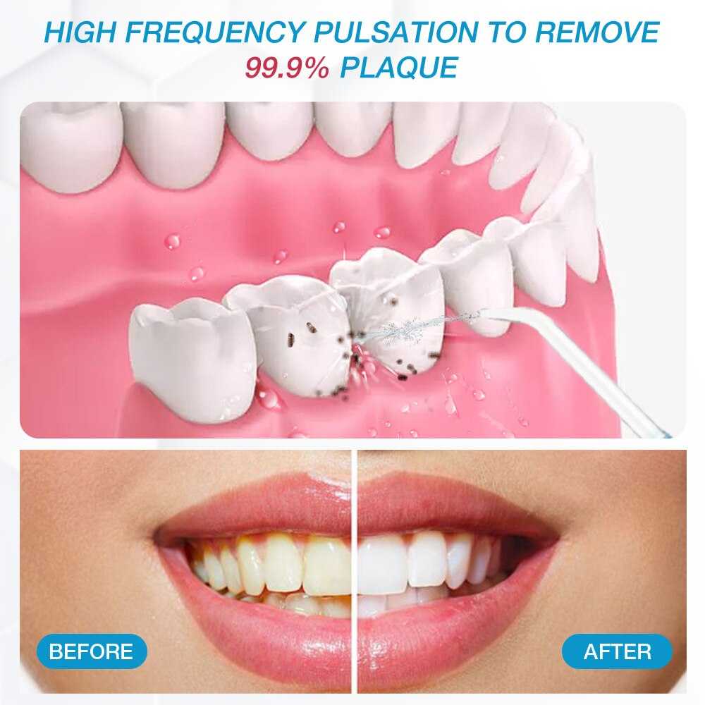 Teeth Whitening Water Flosser 10 Modes Oral Irrigators Cleaning Tools V300 For Family