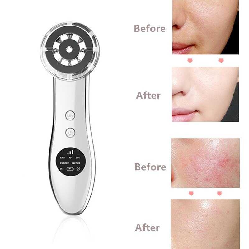 Facial Skin Care Device IR Infrared IPL Skin Rejuvenation RF Radio Frequency