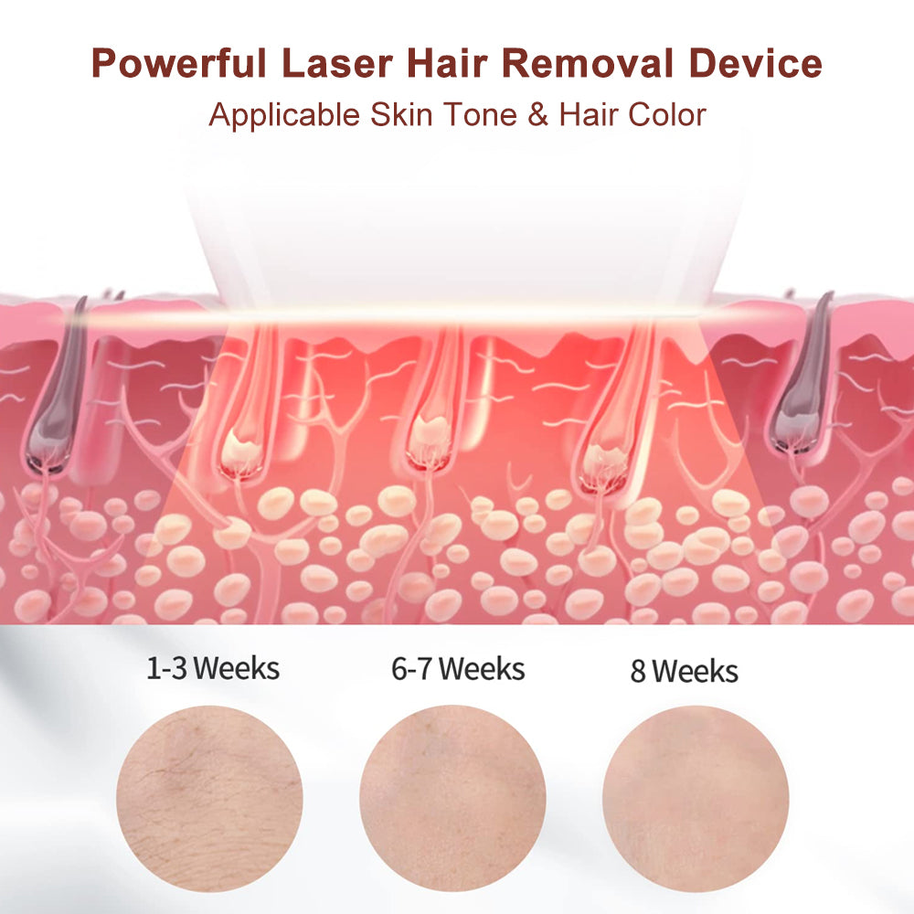Hair Removal IPL Laser Epilator Facial Pulsed light depilator facial