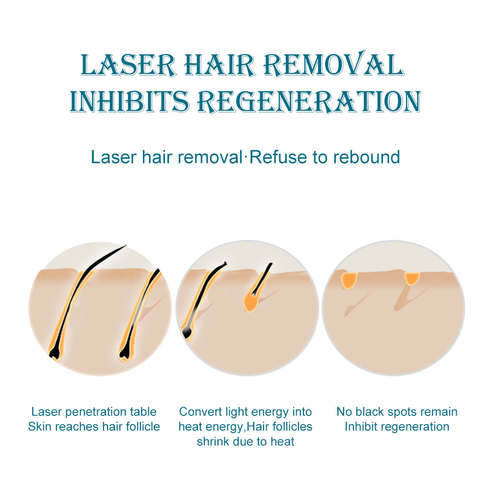 IPL Electric Personal Hair Removal Machine