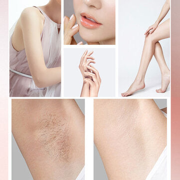 IPL hair removal device Full body hair removal - Flash 999,000 - A07