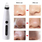 Blackhead Remover Vacuum Cleaner Black Dot Machine Skin Pore Suction