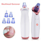 Vacuum Cleaner Blackhead Remover Black Dot Machine Skin Pore