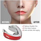 6 Modes Facial Lifting Device LED Photon Heating - TEXVIN