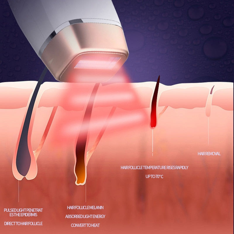 999999 Flashes Laser IPL Hair Removal - TEXVIN