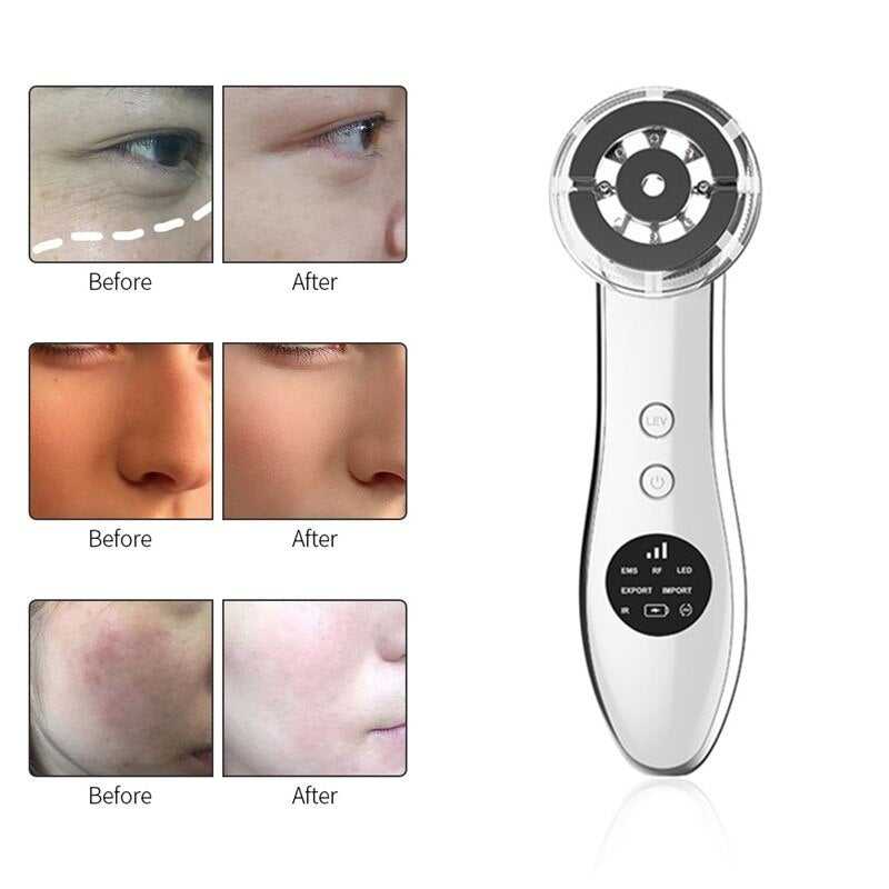 Facial Skin Care Device IR Infrared IPL Skin Rejuvenation RF Radio Frequency