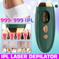 IPL hair removal device Full body hair removal - Flash 999,000 - A10